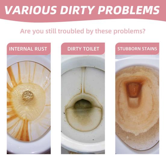 Yousheng 12Pcs Toilet Cleaning Effervescent Tablets Fast Acting Quick Dissolving Long-lasting Urine Stain Remover Toilet Tank Cleaning Tablets