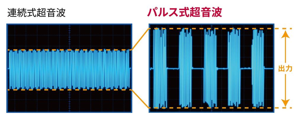 By a Dental University Reclean Reclean Foam Set Ultrasonic Electric Electric Toothbrush Gel High Concentration Periodontal Gingivitis Plaque Oral Care
