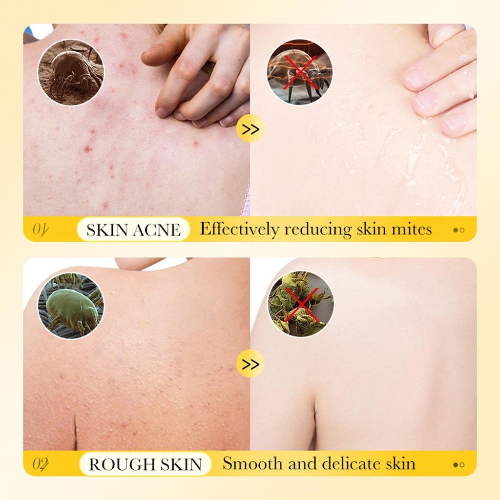 Гель для душа Sulfur Anti-Mite используется для зудящей кожи и может эффективно очищать и питать сухую, потрескавшуюся и зудящую кожу.