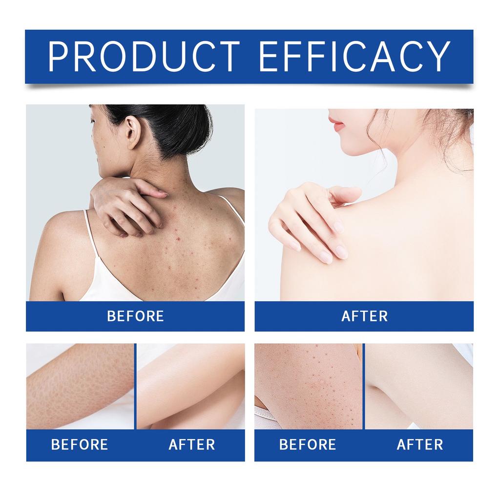 Skin Care Serum Oil Moisturizing Nourishing Bright Skin Moisturizing Tender Skin Massage Care Serum Oil(30ml)