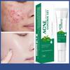 Acne And Acne Mark Care Facial Skin Cleansing Lotion