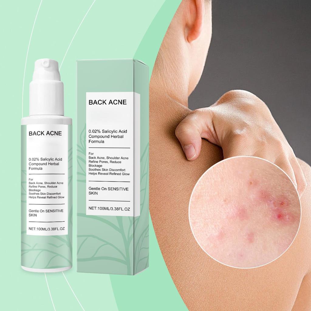 Спрей для ухода за кожей спины Разглаживающий, Осветляющий, Сужающий поры и Мягкий спрей для ухода за кожей, склонной к акне 100 мл