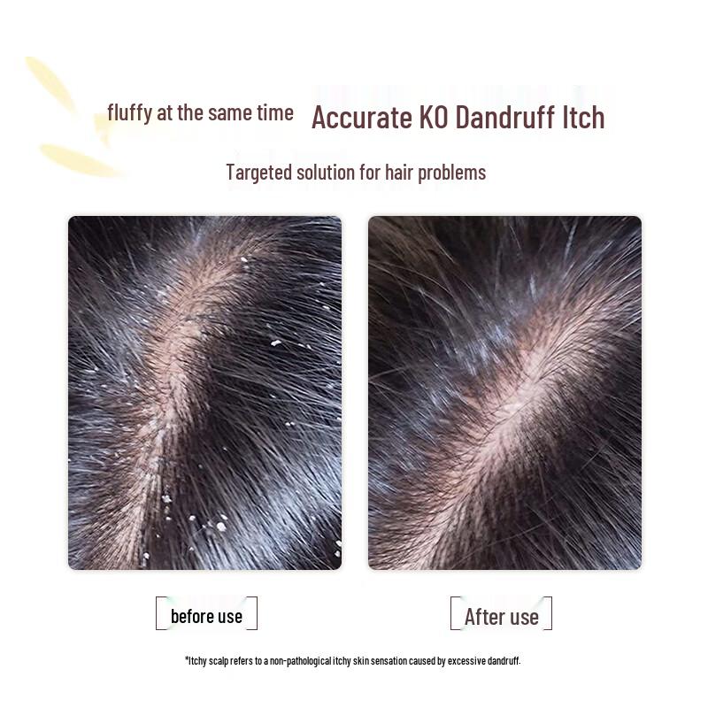 ASAKA Yuzu Anti-Dandruff & Volumizing Shampoo