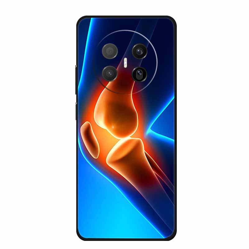 Черный силиконовый чехол для Huawei Mate 70 Air 2025 Чехол Мультяшный кот Мягкая задняя крышка для телефона Huawei Mate 70 Air Чехол Funda Coque