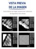 Дентальный рентгеновский датчик с 9 языками, более быстрая переработка, прочный USB-дентальный рентгеновский датчик, внутриротовая камера, цифровой датчик RVG