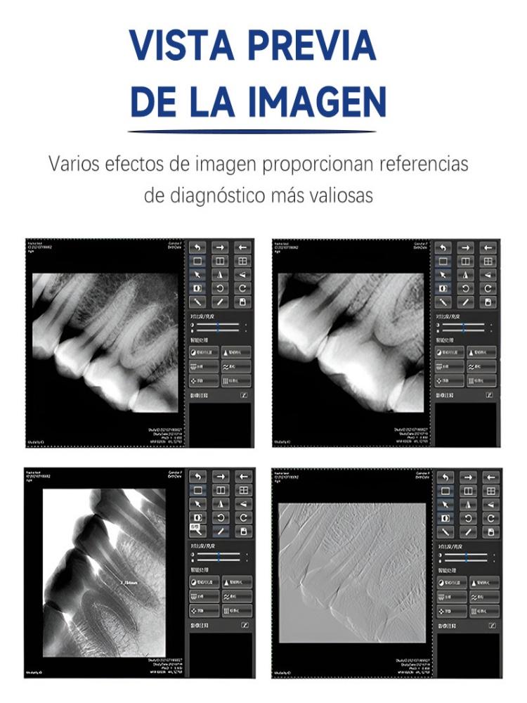 Дентальный рентгеновский датчик с 9 языками, более быстрая переработка, прочный USB-дентальный рентгеновский датчик, внутриротовая камера, цифровой датчик RVG