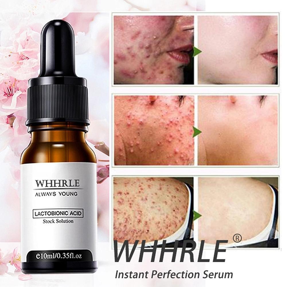 Сыворотка Антивозрастная сыворотка с лактобионовой кислотой Увлажняющая сыворотка для удаления морщин Подтяжка морщин Укрепляющая сыворотка для лица