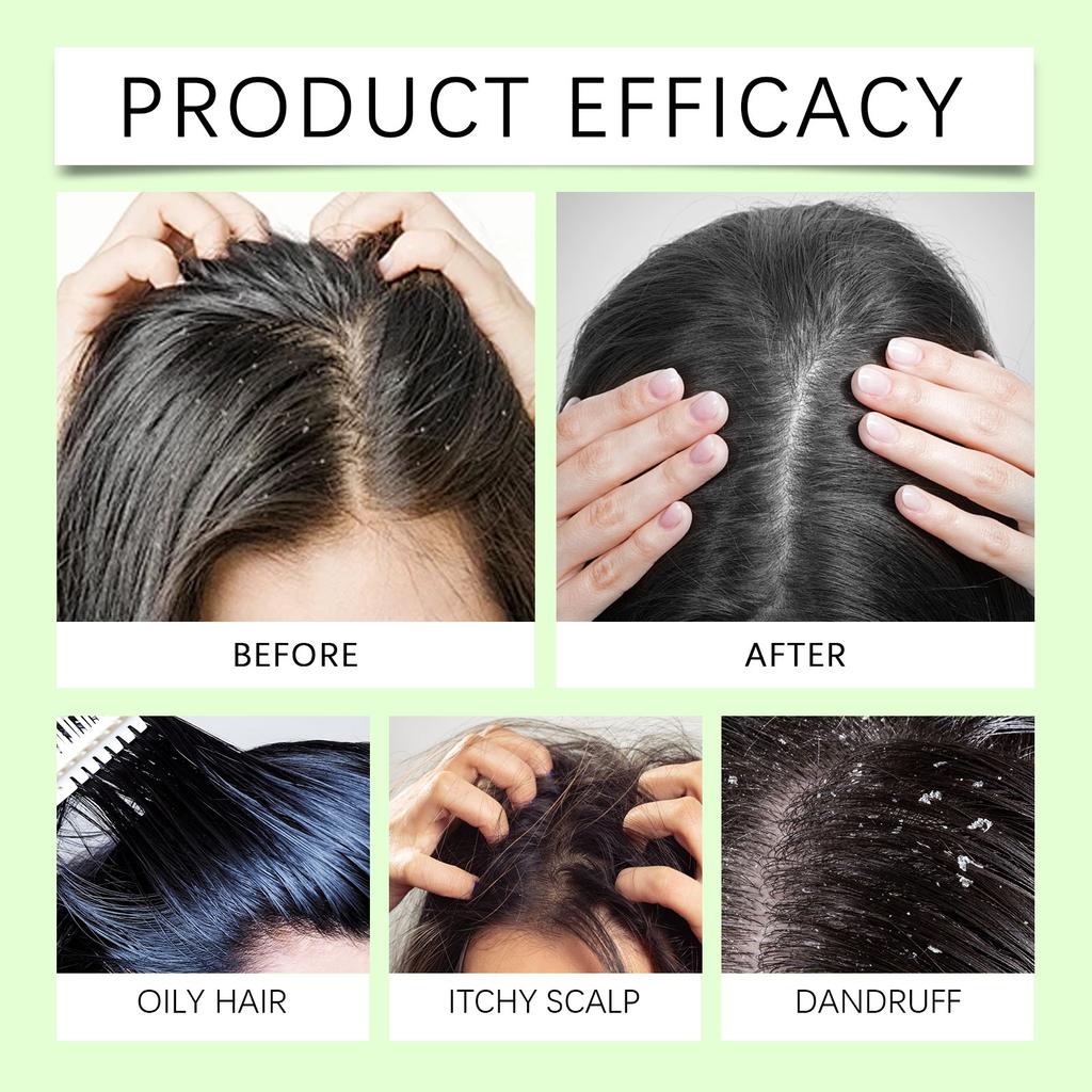 Scalp Care Scrub Sea Cleanser Oil Control -dandruff Soft Hair Refreshing Scalp Clean