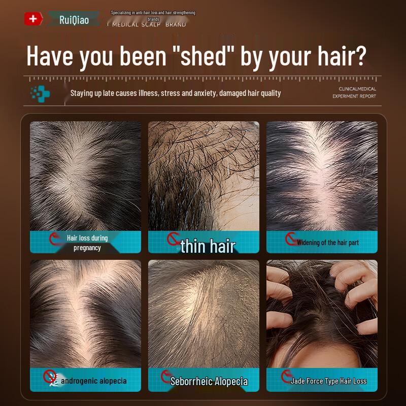 FIVERAMS Anti-Hair Loss Shampoo with Ginger & Arborvitae Leaf, 500ml