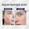 1-3X A-313 Vitamin A Retinol Cream A~313 Retinol Anti-Aging Cream for Face, Reduces Pores & Wrinkles, Treats Acne & Dark Spots New Arrival