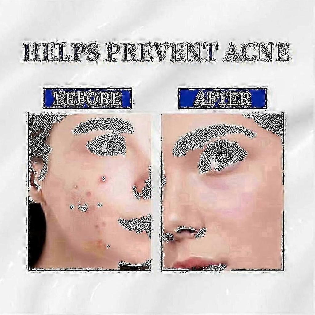 1-3X A-313 Vitamin A Retinol Cream A~313 Retinol Anti-Aging Cream for Face, Reduces Pores & Wrinkles, Treats Acne & Dark Spots New Arrival