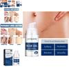 Jaysuing Scar Repair Gel For Fading Pregnancy And Surgical Scars Smooth Nourishing Skin