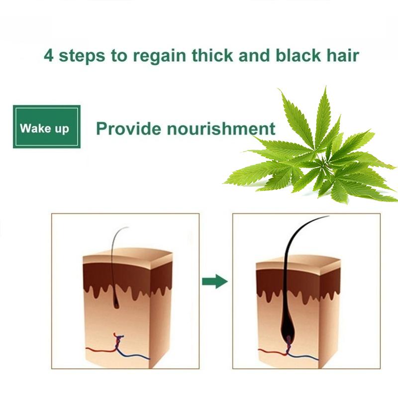 Спрей для роста волос, эссенционное масло против выпадения волос, быстрое лечение, предотвращение истончения волос, сушка, восстановление локонов