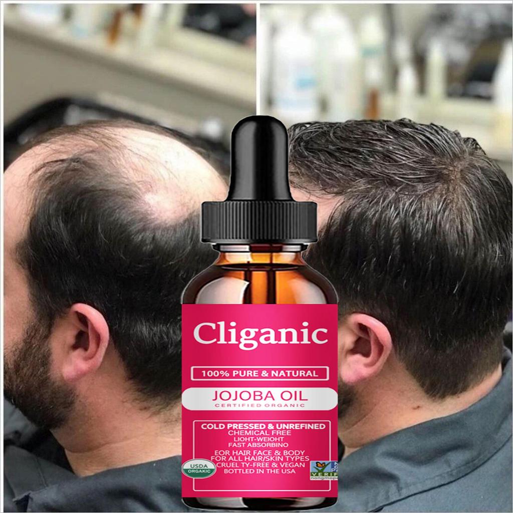 Сыворотка для роста волос, масло, быстрый густой натуральный уход за волосами, восстановление кожи головы, предотвращение выпадения волос, средства для восстановления поврежденных волос