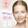 Whitening Freckle Cream Remove Dark Spots Melanin Melasma Brighten Face Cream Pigmentation Anti-Aging Skin Care Cosmetics