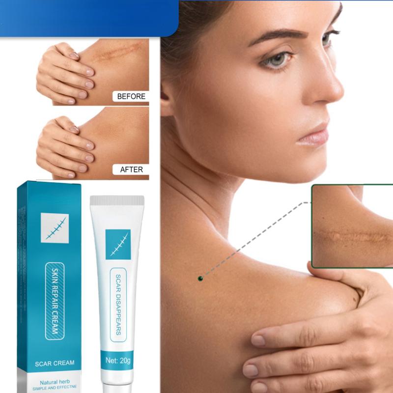 20 г крем для восстановления шрамов, естественный уход за растяжками и обожженной кожей, хирургический крем для восстановления шрамов