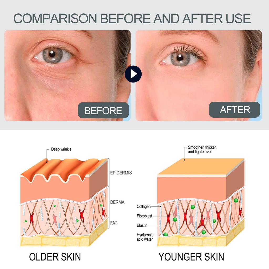 Коллагеновая сыворотка увлажняет, питает и укрепляет кожу с помощью нежной сыворотки для лица.