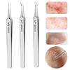 Пинцет для удаления угрей и черных точек, игла для удаления угрей из нержавеющей стали, экстрактор для удаления дефектов кожи, набор для удаления угрей для чистой кожи