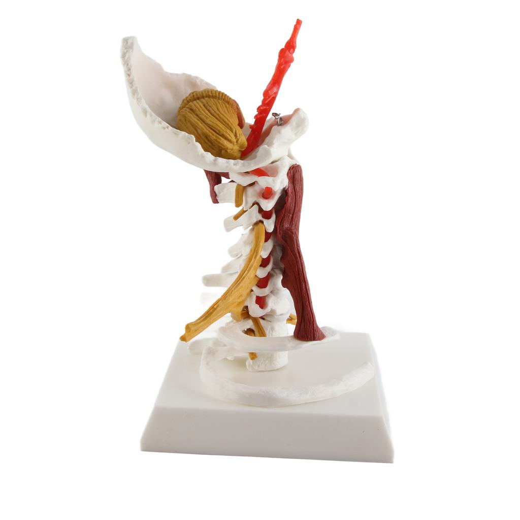 Cervical Spine Model Removable Human Spinal Nerves Model for Doctor Patient Communication Teaching Presentation