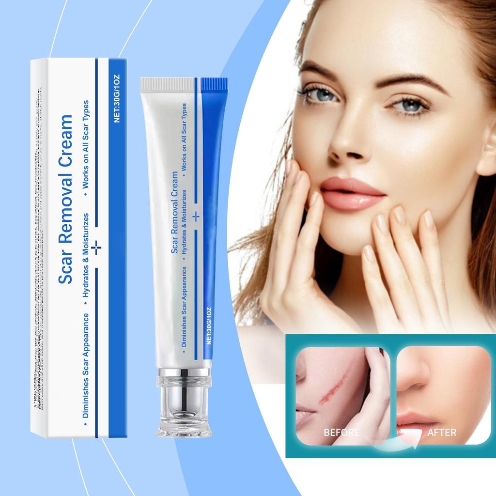 Ухаживающий гель от акне, растяжек, пигментных пятен беременности, отложения меланина, мягкий и успокаивающий, эффективно осветляет следы от шрамов