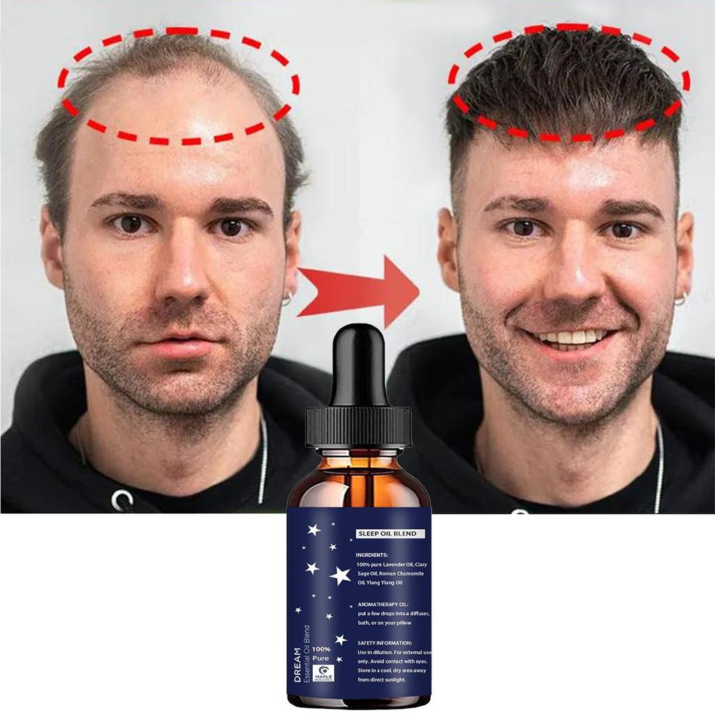 Натуральное эфирное масло для быстрого роста волос, средство против выпадения волос, эссенция для роста волос, лечение алопеции для женщин