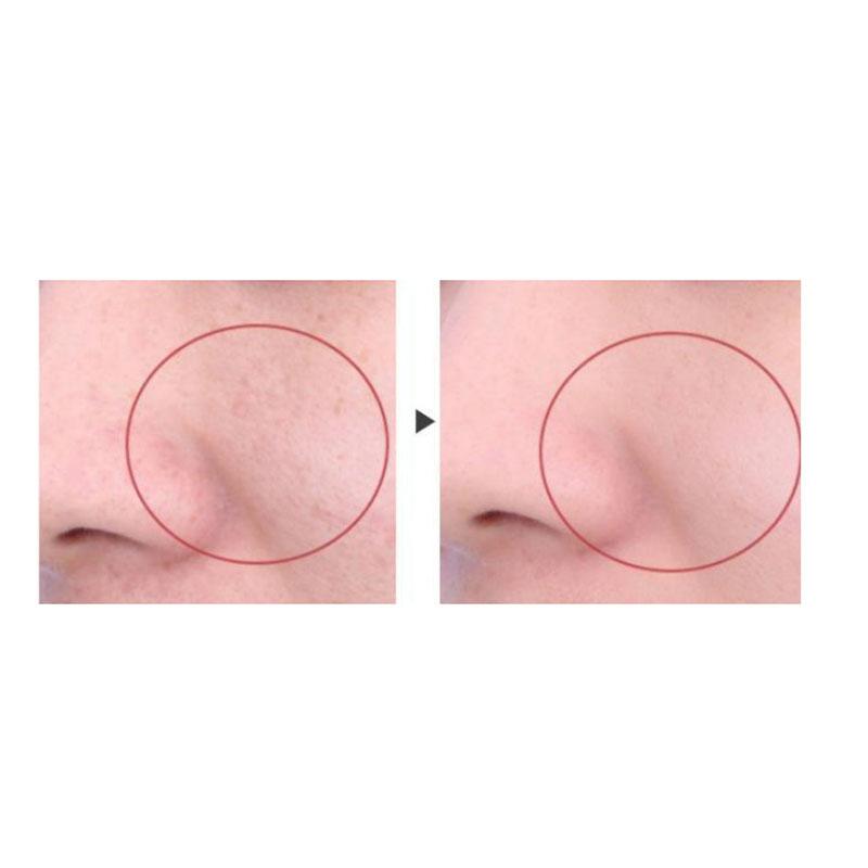 Гексапептидный крем против морщин, антивозрастной, укрепляющий, увлажняющий крем, эссенция для лица