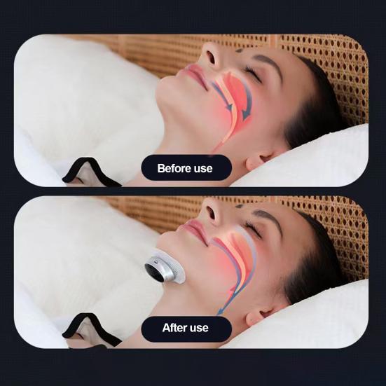 Electric Anti-snoring Device with Patches Silent Type-C Rechargeable Adjustable Smart Throat Pulse