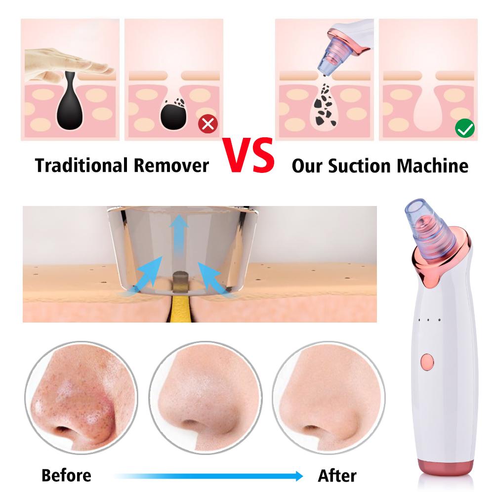 Electric Vacuum Blackhead Removal Facial Cleansing Black Spots Suction Acne Pimple Remover Beauty Instrument Skincare Tools
