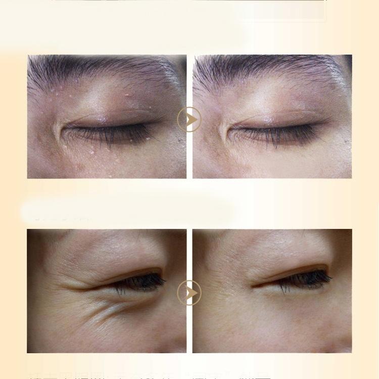 Укрепляющий крем для глаз с лошадиным маслом от темных кругов, морщин, жировых гранул и антивозрастной эссенции для глаз, крем для удаления темных кругов под глазами(5г/15г/30г/50г)