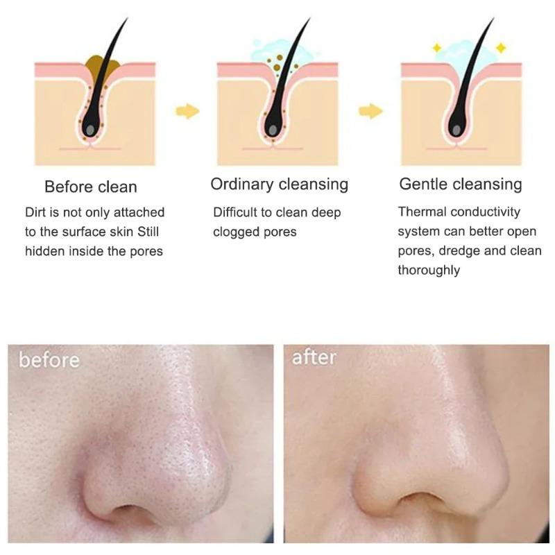 Щетка для очищения лица, инструменты для ухода за кожей лица, водостойкий силиконовый электрический звуковой очиститель, косметический массажер для лица