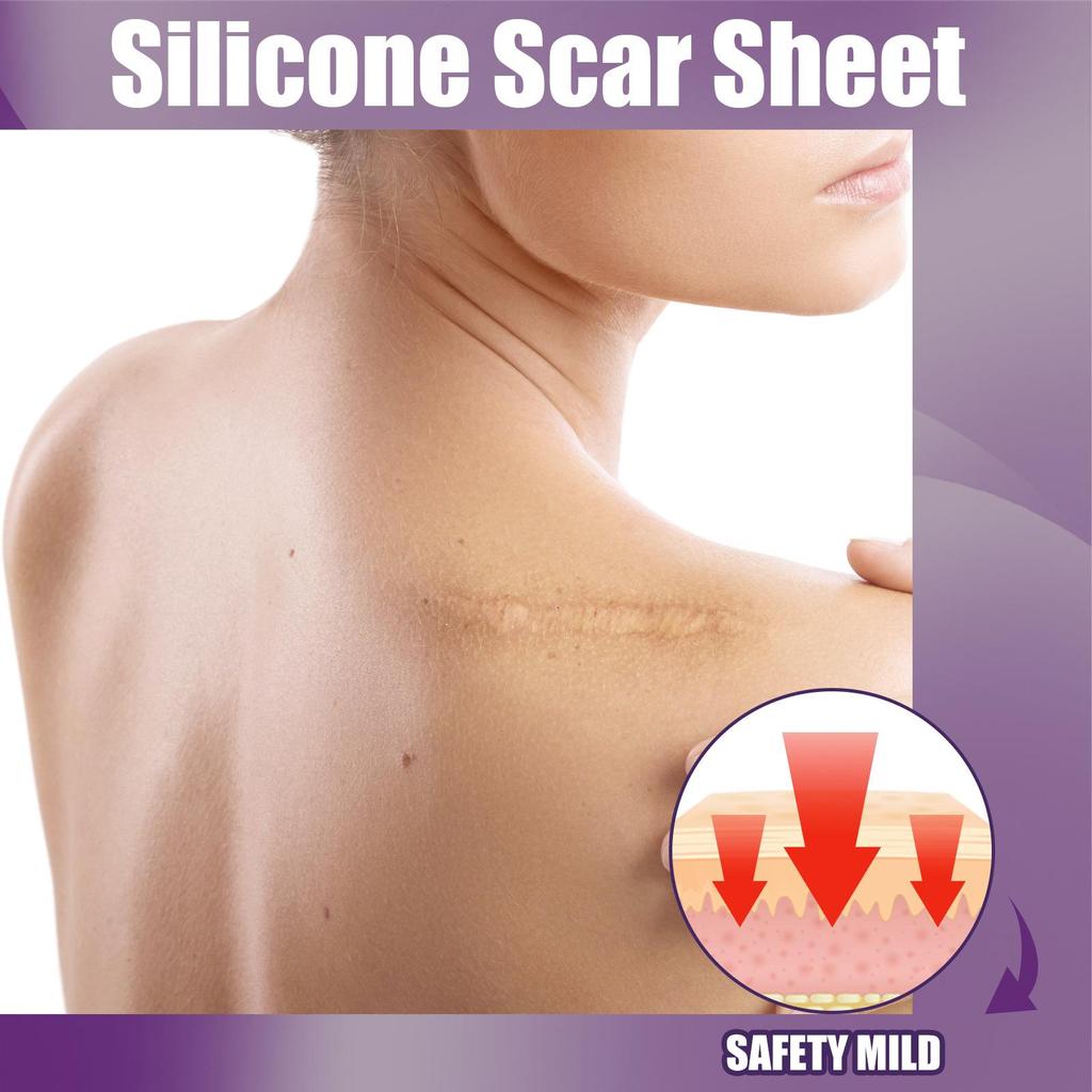 Silicone Scar Tape Scar Sheets for Removing Scars Adaptable Easy-Tear Scar Tape Reusable for C-Section