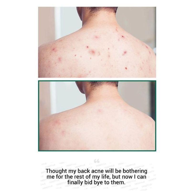 SOME BY MI AHA, BHA, PHA 30 Days Miracle Очищающий брусок 1 шт.