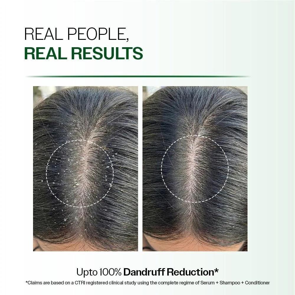 Bare Anatomy Advanced Anti Dandruff Serum Lightweight & Non-Sticky Formula 50ml