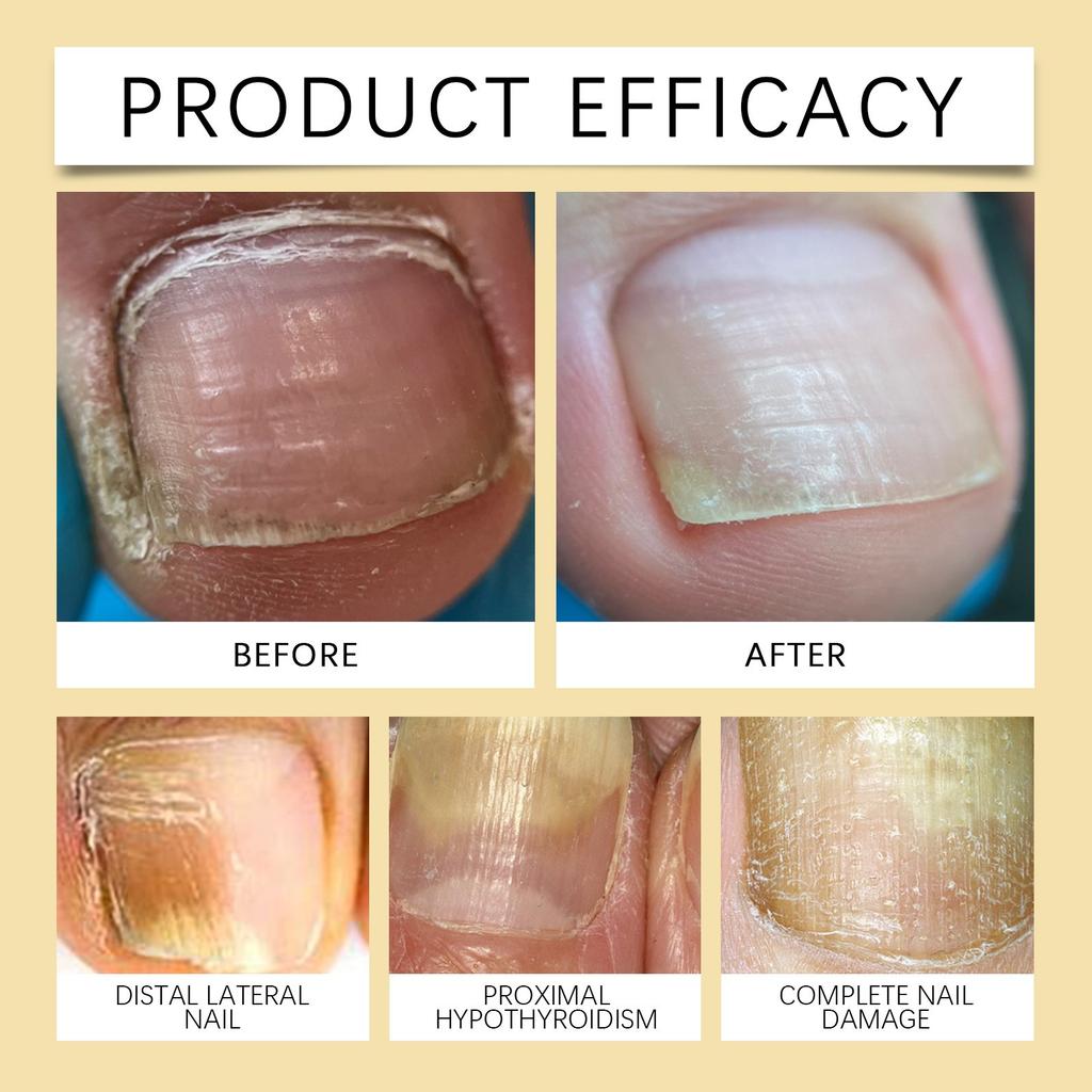 Карандаш для ногтей, ноготь, уход за ногтями рук и ног, уход за ногтями на неделе, нежный и питательный, блестящий ноготь 2 мл