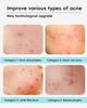 Portable Electronic Pimple Patch with Red/Blue Light Therapy for Rapid Acne Shrinking and Scar Fading
