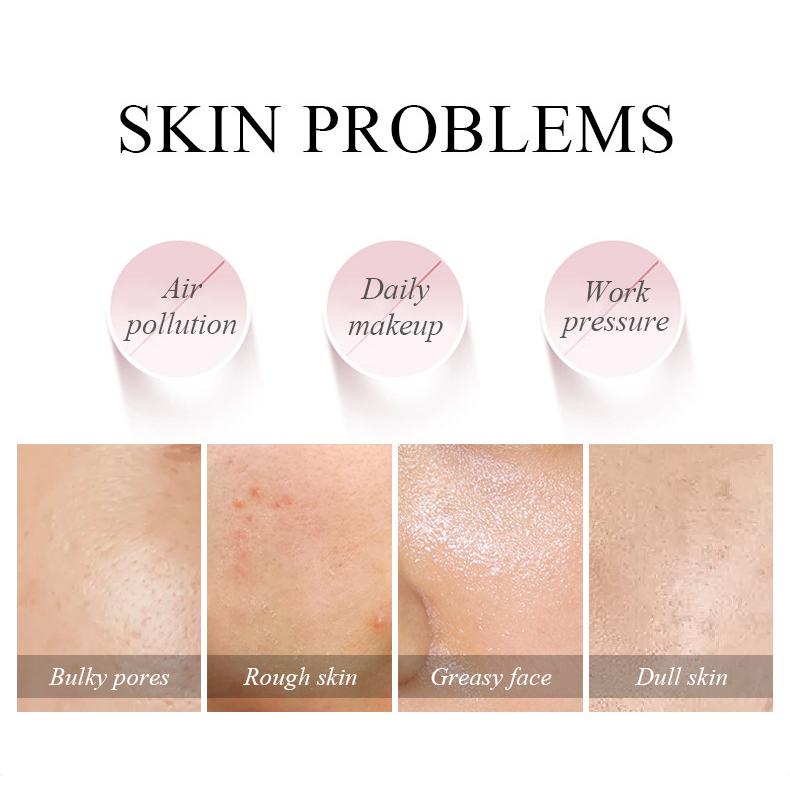 Маска сакуры, грязевая, цельная, 5 г, уход за кожей лица, глубокое очищение пор, удаление черных точек и прыщей, контроль масла, грязевая маска, маска для нанесения