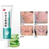 Anti-Acne Cream with Aloe Vera Extract Shrink Pores Sleep Cream 30g