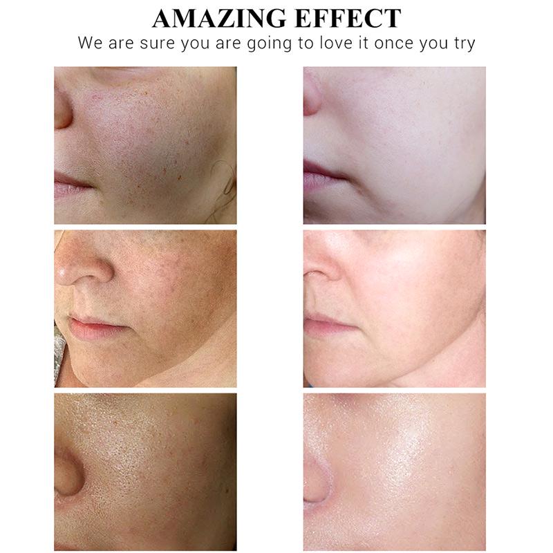 50 г дневных кремов с витамином С, осветляющих кожу, осветляющих тонкие линии, оживляющих и увлажняющих водный крем для лица