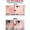1+1/2+2 Spot Care Essence Mask Pack Wash-off Type Mask Pack Cool Soothing Mask Brightening Skin Texture Relief/wrinkle Improvement 100ml, [1+1]*100ml