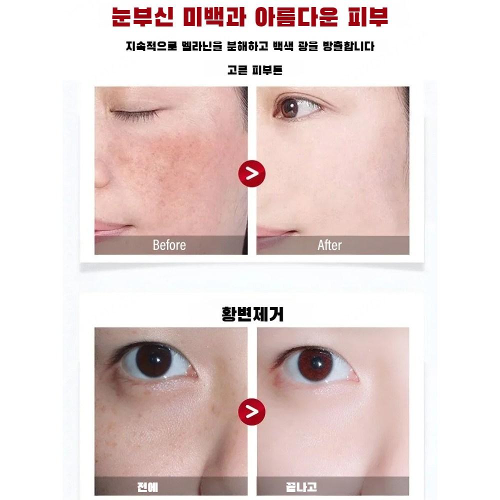 1+1/2+2 Spot Care Essence Mask Pack Wash-off Type Mask Pack Cool Soothing Mask Brightening Skin Texture Relief/wrinkle Improvement 100ml, [1+1]*100ml