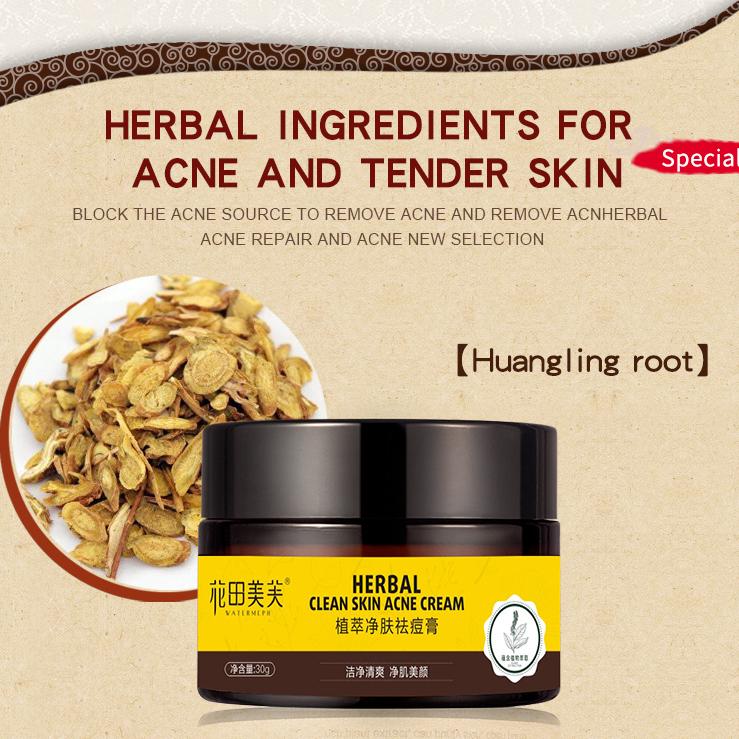 Крем с травами, крем против шрамов от прыщей, крем для лица, контроль жирности, восстанавливающий крем от прыщей, уход за лицом, отбеливающий крем, 30 г