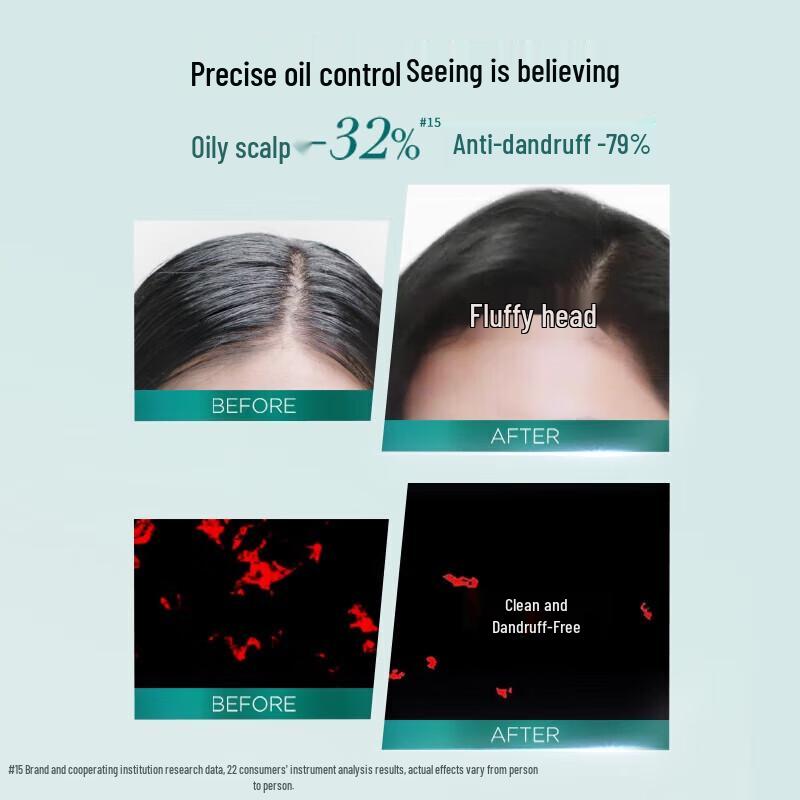 L'Oréal Salicylic Acid Anti-Dandruff & Oil Control Shampoo