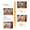 BREYLEE - Антивозрастная сыворотка для лица с витамином С и витамином Е, антивозрастная, отбеливающая, эссенция, масло для местного применения, гиалуроновая кислота, косметическое средство, 17 мл