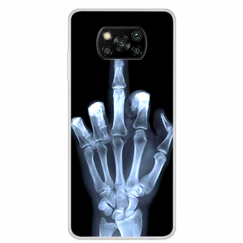 Чехол для Poco X3 Pro X3 NFC 6.67" Прозрачный Мраморный Мягкий ТПУ Силиконовый Задний Чехол для Телефона Xiaomi Poco X3 NFC Ударопрочный Fundas