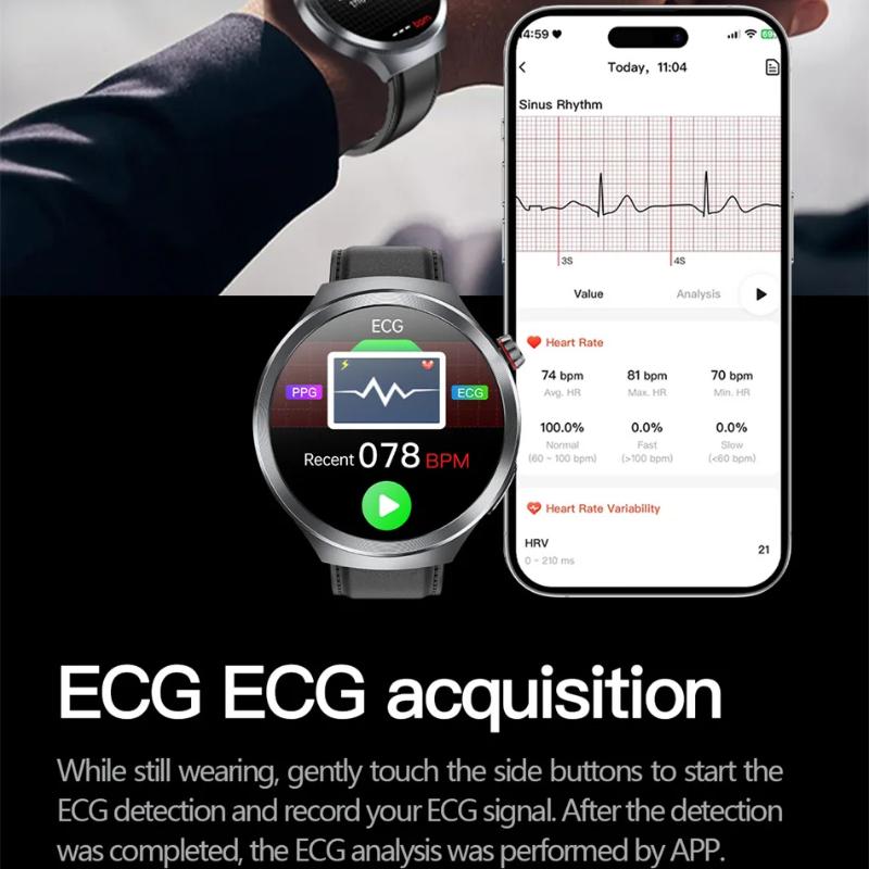2025 New Uric Acid Blood Pressure Blood Oxygen Body Analysis Smart Watch ECG+PPG Clock Bluetooth Call Smart Watch Men Fatigue Monitoring