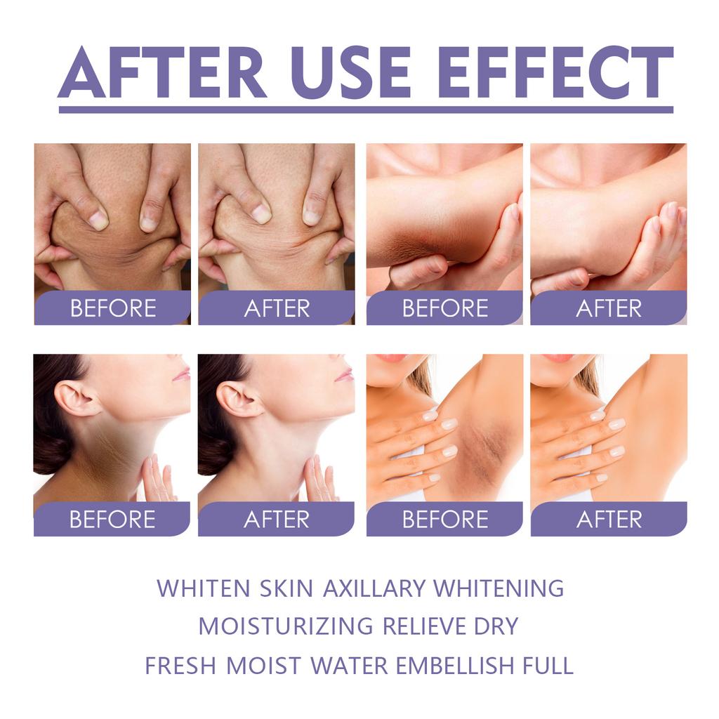 EELHOE Body Whitening Stick Underarm Knee Buttocks Private Bleach Remove Melanin Pigmentation Improve Dull Nourish Brighten Skin Care