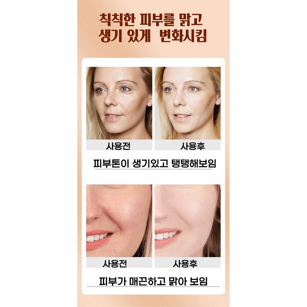 [1/1+1] Сыворотка Bakuchiol Pore Ampoule для удаления темных пятен, пигментных пятен, веснушек, отбеливающий крем для пигментации 30 мл, 2 шт.