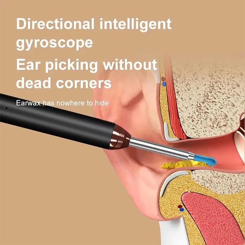 Tinsol Smart Visual Ear Cleaner 1296P Ушные палочки Отоскоп USB C Зарядка Эндоскоп Инструмент для удаления ушной серы Камера для чистки ушей Здравоохранение