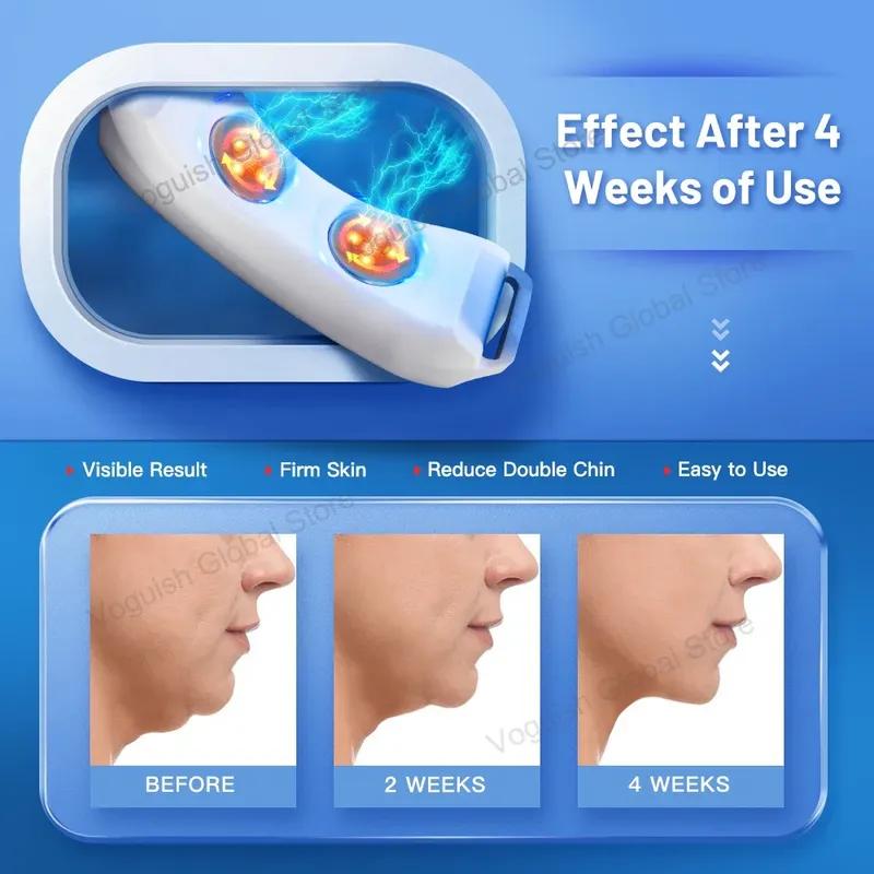 Массажер для лица EMS V-Shape, средство для уменьшения двойного подбородка, устройство для похудения лица с тепловой вибрацией