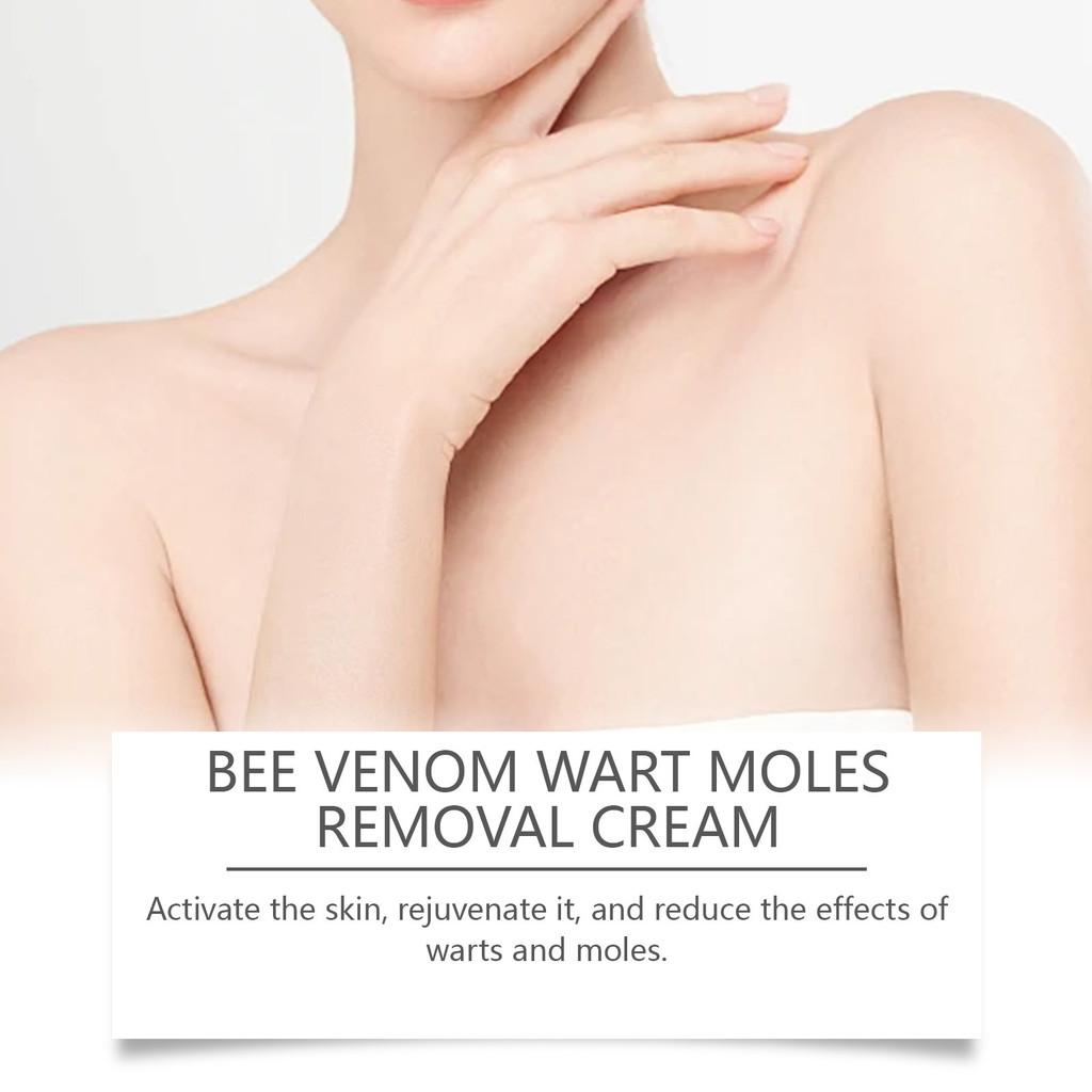 Крем для восстановления кожи Ximonth Herbal для мягкого удаления и питания кожных папиллом